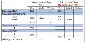 Kết quả trước và sau khi sử dụng Stopstent 30 của khách hàng Nguyễn Văn Chấn